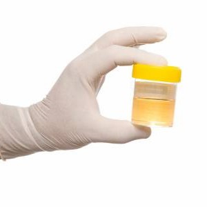 Pathogenic bacteria in the urine, what does it mean?
